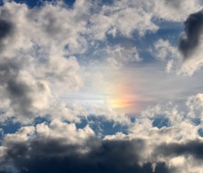 怀孕初期有褐色分泌物做阴超